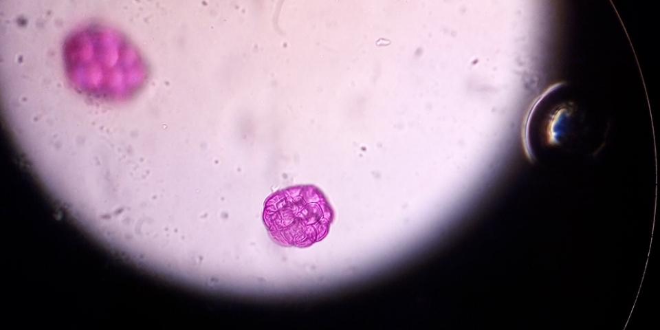 Mimosa pollen grain